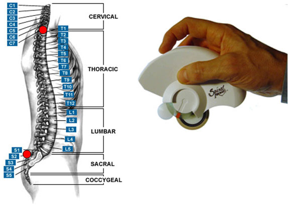 spinal1